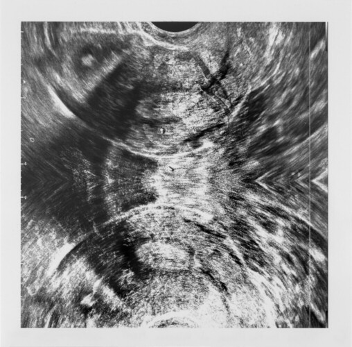 Étude corporelle No. 1: Polyps in the Flank of Volcanic Maat	